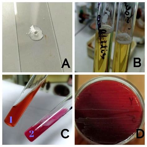 bacillus subtilis catalase test